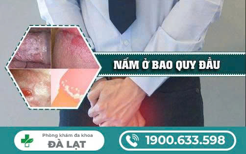 Hình ảnh minh họa